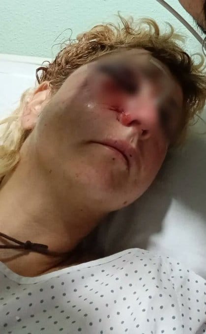 Una de las heridas tras el ataque en Errekaleor. Foto: Errekaleor Bizirik