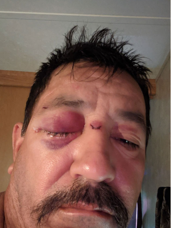 Florentino Rios, trabajador de SpaceX golpeado por una cadena. Foto Reuters