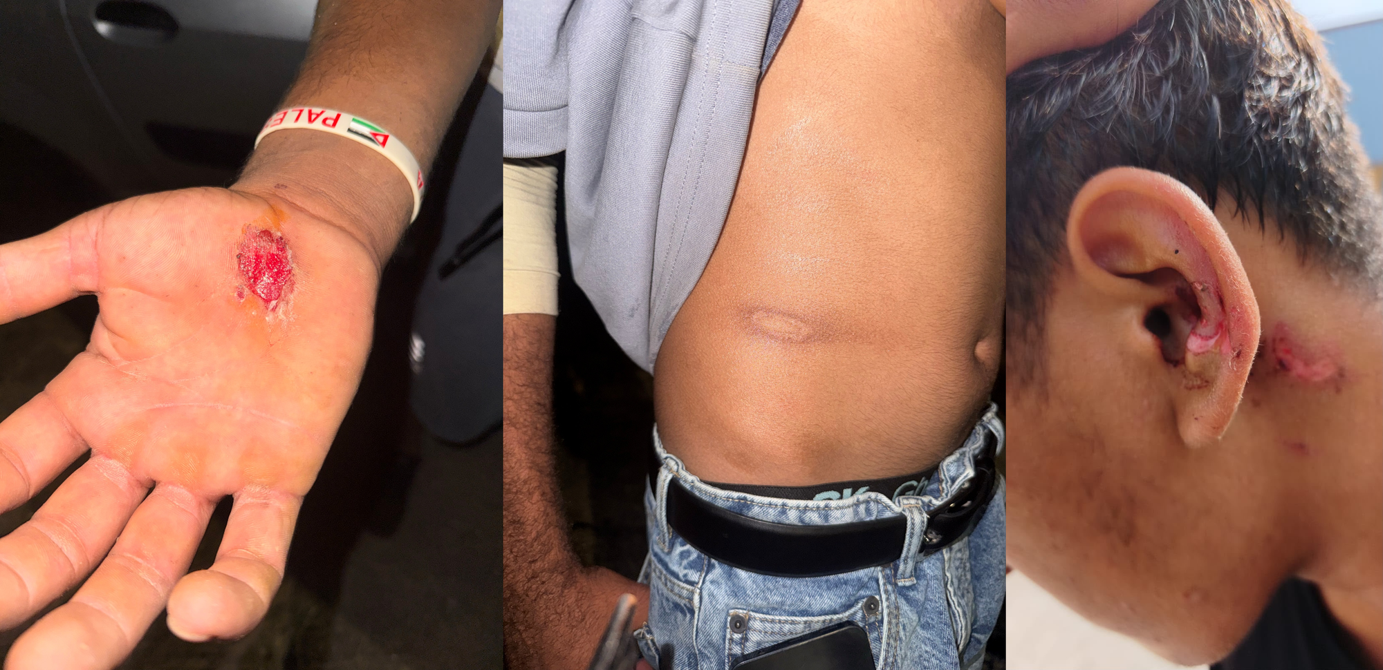 Herida de un porrazo / Infección de oído (la mayoría de personas están enfermas, con heridas, golpes, infecciones…) / Heridas después de una persecución. Fotos: Yasin Chekroun Casas