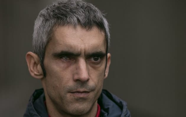 Imagen de archivo de Roger Español, herido en un ojo por la Policía española el 1-O. Foto: elnacional.cat