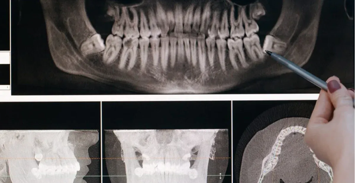 Imagen de archivo de una radiograf´ía de una dentadura. Foto: N//D