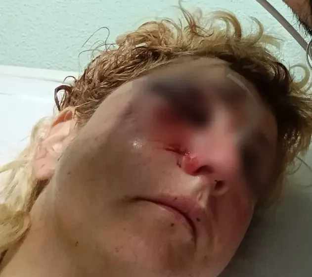 Errekaleor denuncia un ataque instigado por la Ertzaintza