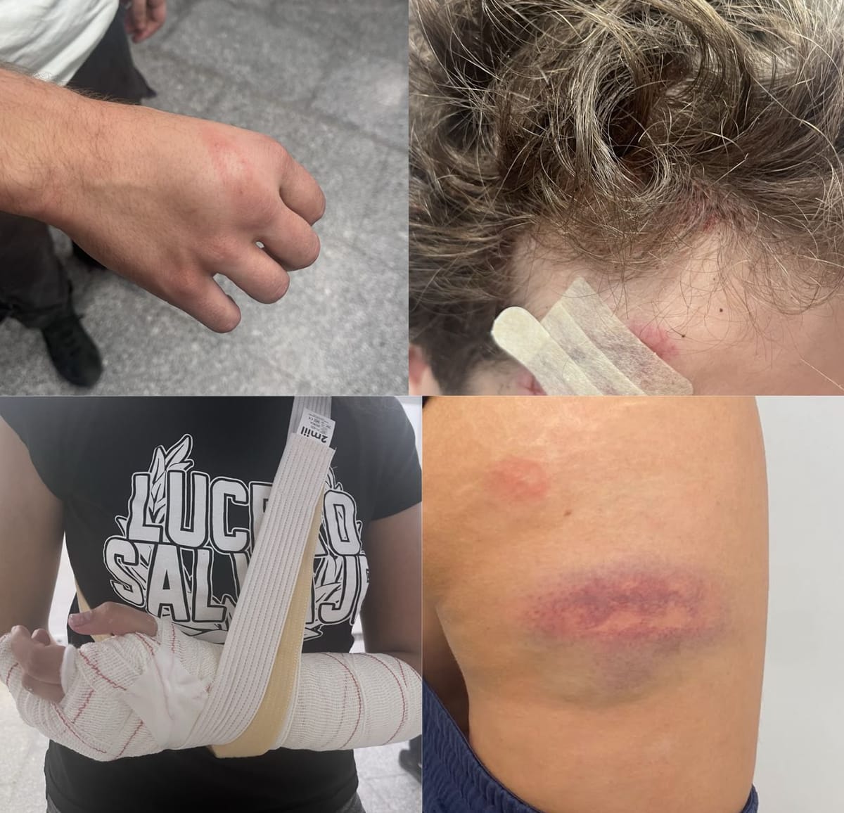 La OES denuncia la violencia policial en la Complutense: traumatismo craneoencefálico, luxaciones, hematomas y roturas de mano