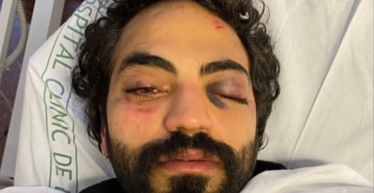 Joven palestino denuncia una agresión sionista en una discoteca de Barcelona