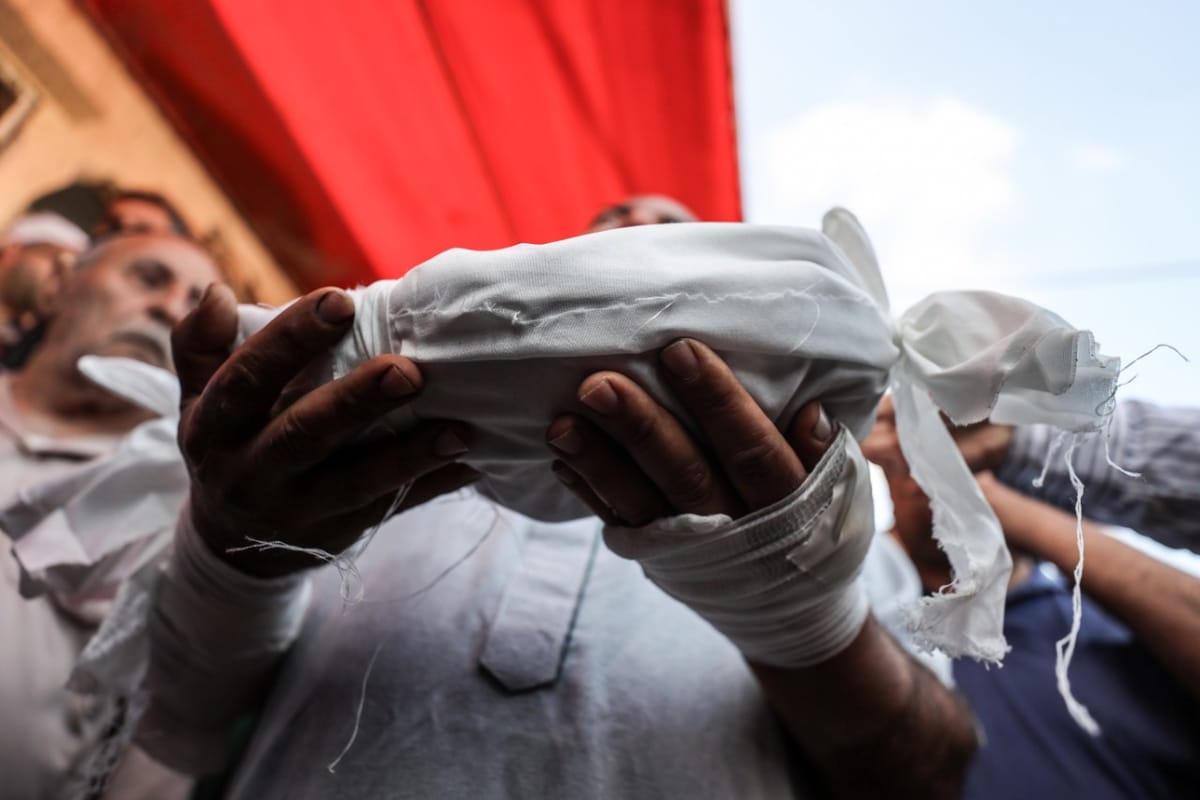 Más de 320 muertes y 300 abortos en Gaza por falta de alimentos y medicinas debido al bloqueo israelí