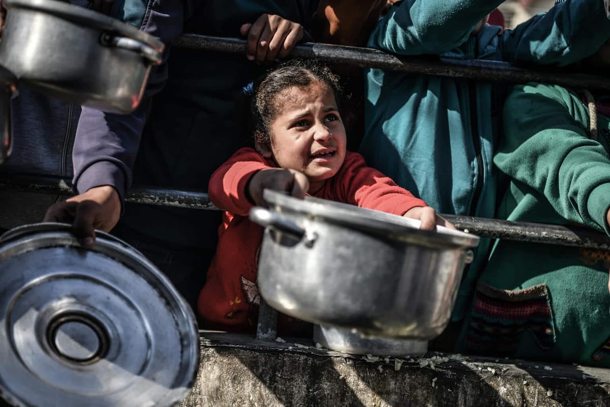 65.000 niños sufren desnutrición grave en Gaza