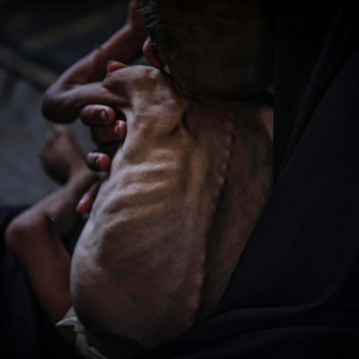 La crisis humanitaria crítica persiste en Gaza a pesar de la "pausa táctica"