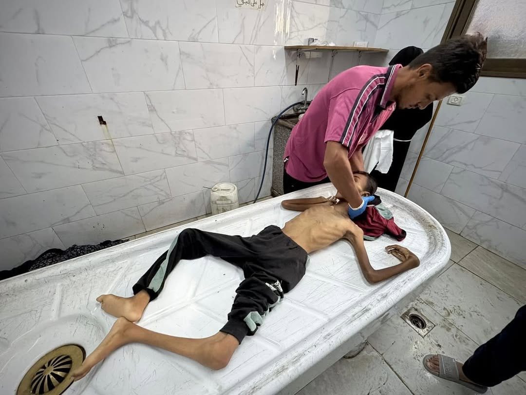 “La hambruna más grave desde 1945”: experto alerta sobre Gaza